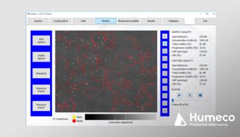 El análisis seminal con SCOPUS (Computer Assisted Sperm Analysis-CASA)