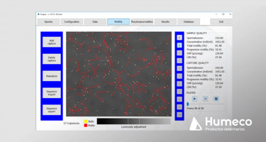 El análisis seminal con SCOPUS (Computer Assisted Sperm Analysis-CASA)