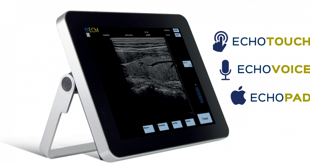 EXAPad, lo último en ecógrafos portátiles